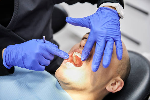 Best Emergency Dentist for Lost Fillings or Crowns in Brooksville, FL